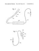 VEHICLE DIAGNOSTIC LISTENING DEVICE AND METHOD THEREFOR diagram and image