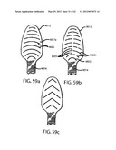 ORAL CARE IMPLEMENT diagram and image