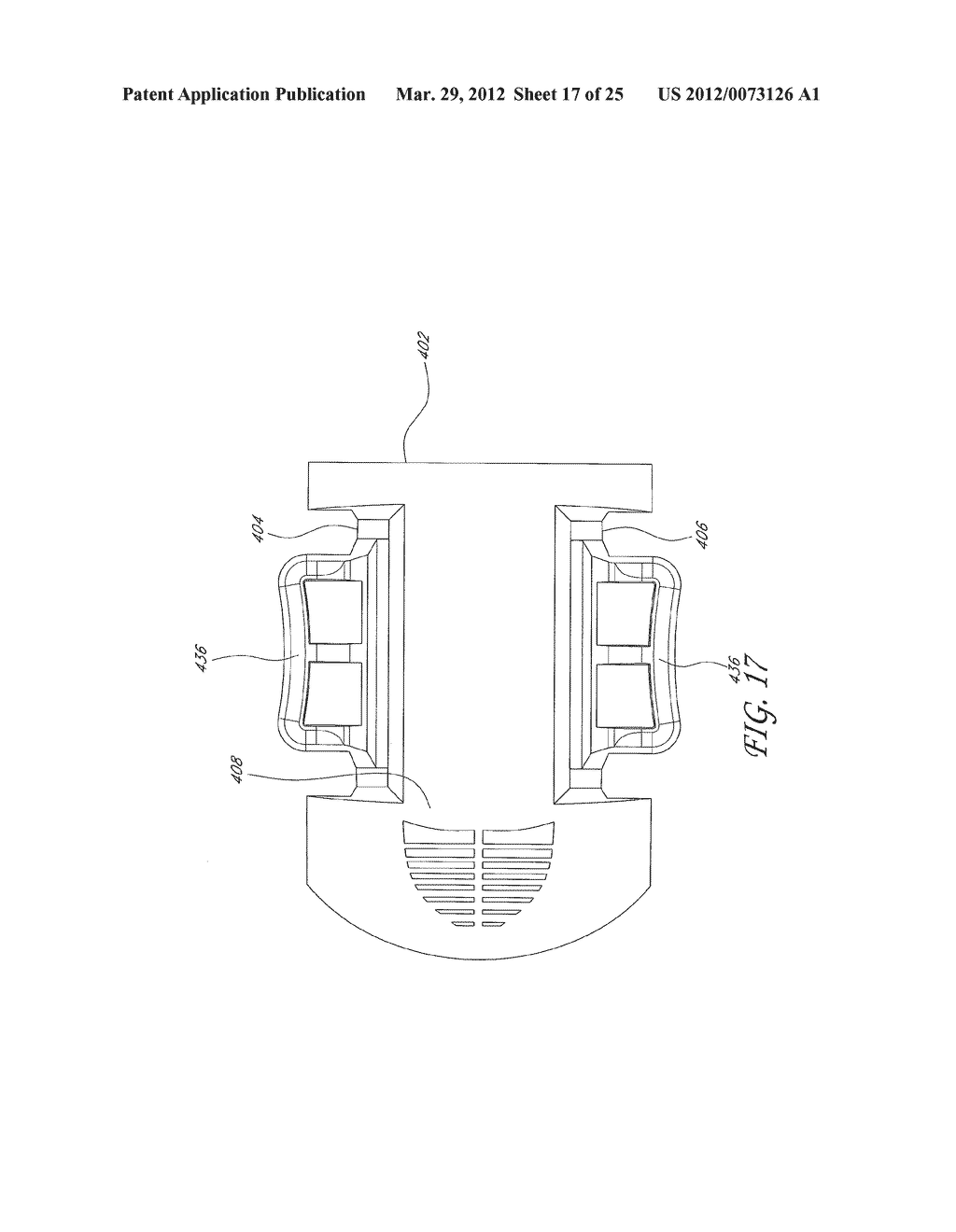 VALVE LOADER METHOD, SYSTEM, AND APPARATUS - diagram, schematic, and image 18