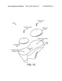 ATTACHABLE CONVEX PLYOMETRIC FOOTWEAR TRAINERS diagram and image