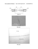 Synchronous One-Pole Surface Acoustic Wave Resonator diagram and image