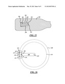 Frictionless Rocking Joint diagram and image