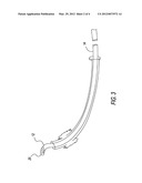 Intubation Stylet & Endotracheal Tube diagram and image