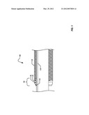 Universal Backup for Swellable Packers diagram and image