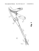 Crimp And Release Of Suture Holding Buttress Material diagram and image