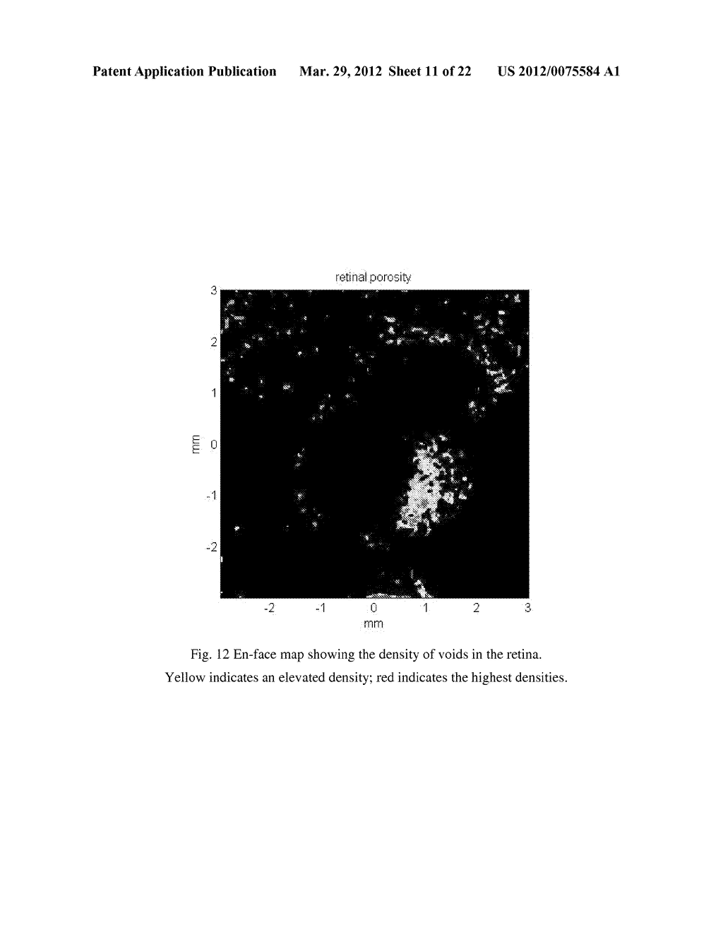 METHODS FOR MAPPING TISSUE WITH OPTICAL COHERENCE TOMOGRAPHY DATA - diagram, schematic, and image 12