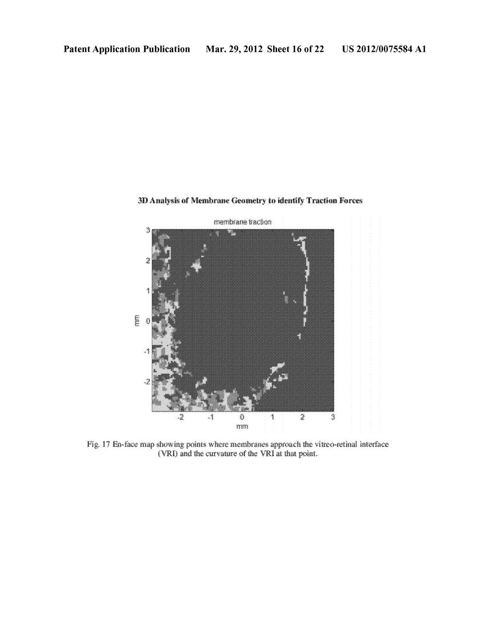 METHODS FOR MAPPING TISSUE WITH OPTICAL COHERENCE TOMOGRAPHY DATA - diagram, schematic, and image 17