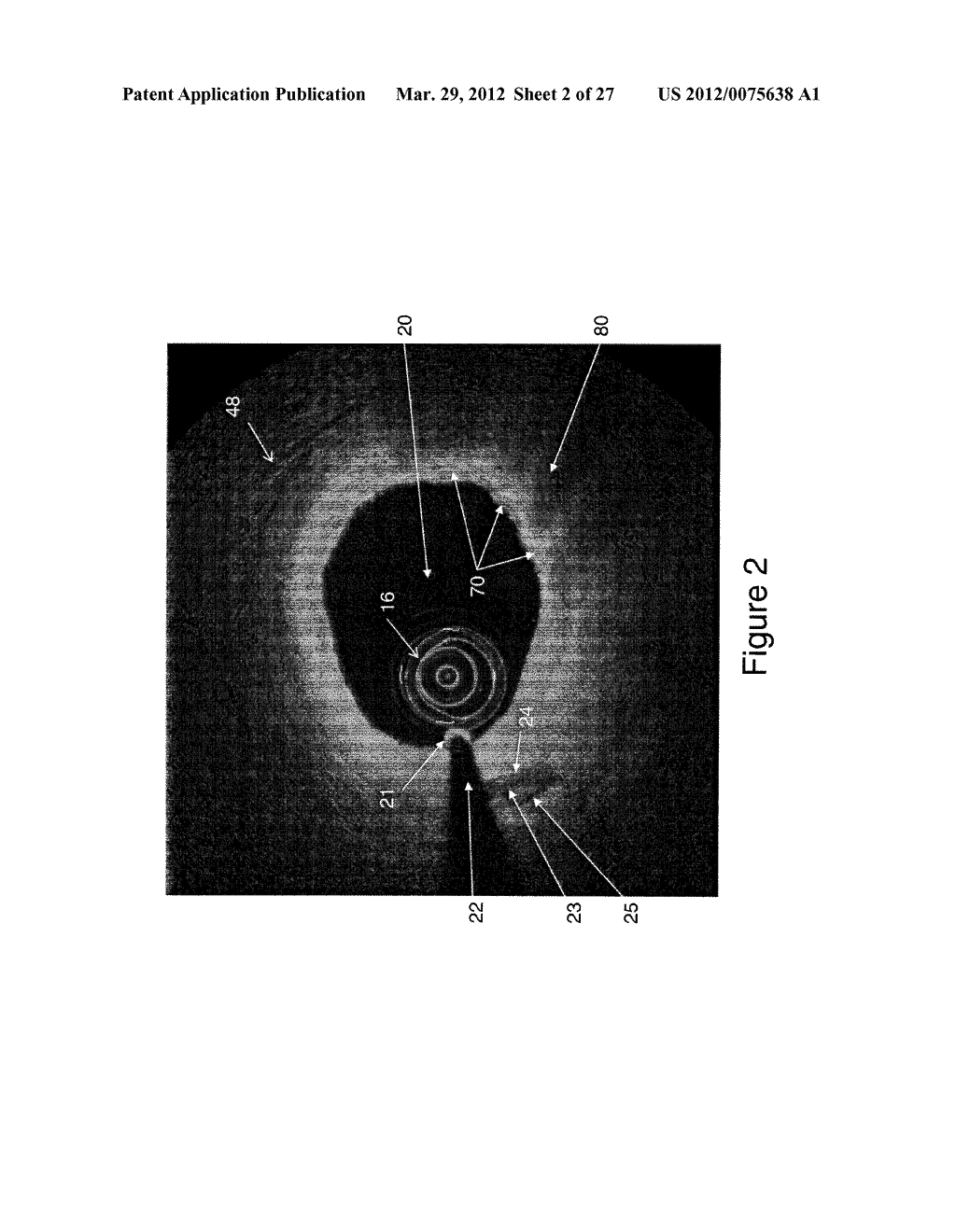 SEGMENTATION AND QUANTIFICATION FOR INTRAVASCULAR OPTICAL COHERENCE     TOMOGRAPHY IMAGES - diagram, schematic, and image 03