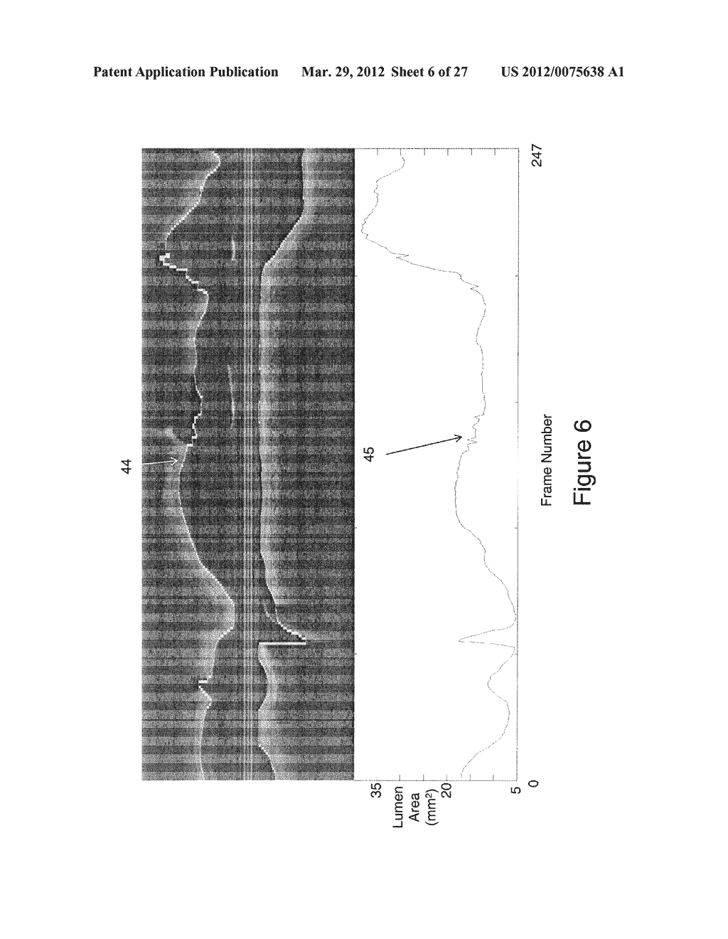 SEGMENTATION AND QUANTIFICATION FOR INTRAVASCULAR OPTICAL COHERENCE     TOMOGRAPHY IMAGES - diagram, schematic, and image 07