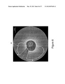 SEGMENTATION AND QUANTIFICATION FOR INTRAVASCULAR OPTICAL COHERENCE     TOMOGRAPHY IMAGES diagram and image