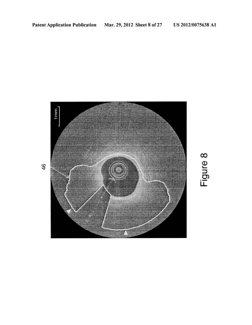 SEGMENTATION AND QUANTIFICATION FOR INTRAVASCULAR OPTICAL COHERENCE     TOMOGRAPHY IMAGES - diagram, schematic, and image 09