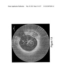 SEGMENTATION AND QUANTIFICATION FOR INTRAVASCULAR OPTICAL COHERENCE     TOMOGRAPHY IMAGES diagram and image