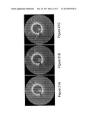 SEGMENTATION AND QUANTIFICATION FOR INTRAVASCULAR OPTICAL COHERENCE     TOMOGRAPHY IMAGES diagram and image
