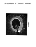 SEGMENTATION AND QUANTIFICATION FOR INTRAVASCULAR OPTICAL COHERENCE     TOMOGRAPHY IMAGES diagram and image