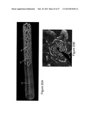 SEGMENTATION AND QUANTIFICATION FOR INTRAVASCULAR OPTICAL COHERENCE     TOMOGRAPHY IMAGES diagram and image