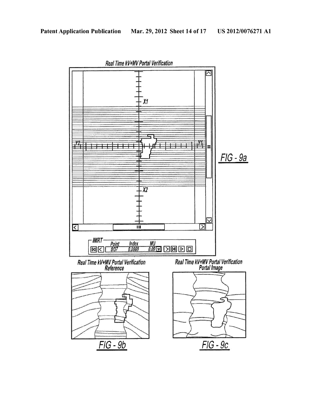 Portal and Real Time Imaging For Treatment Verification - diagram, schematic, and image 15