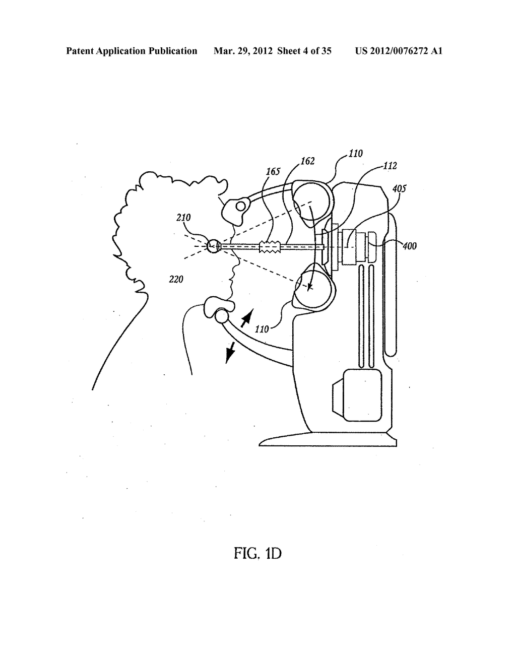 OCULAR RADIOSURGERY - diagram, schematic, and image 05