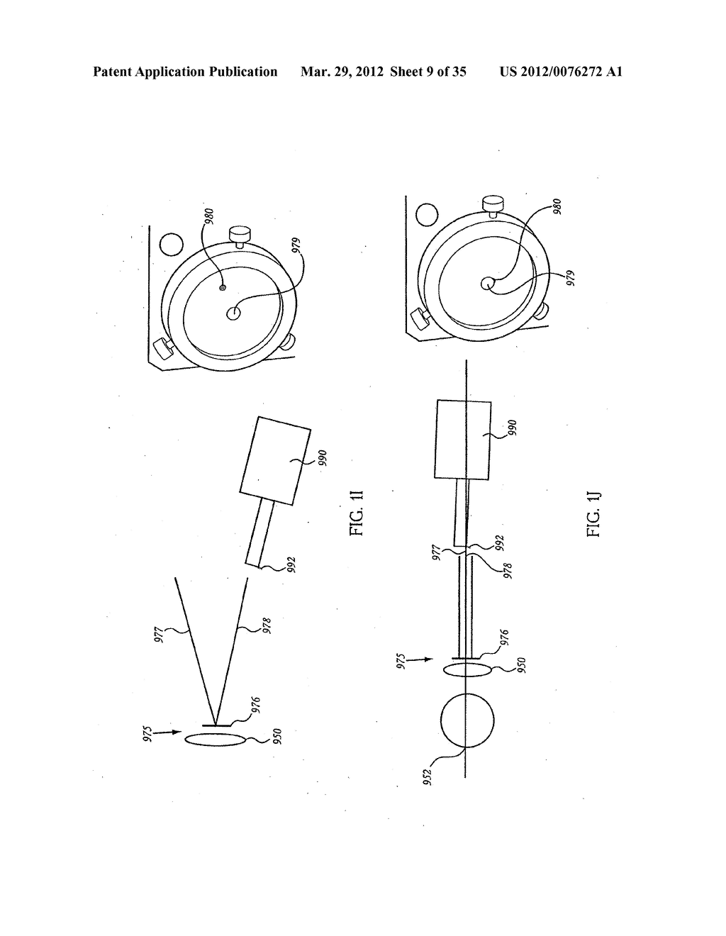 OCULAR RADIOSURGERY - diagram, schematic, and image 10