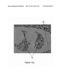 SYSTEM AND METHOD FOR BACKGROUND PHASE CORRECTION FOR PHASE CONTRAST FLOW     IMAGES diagram and image