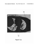 SYSTEM AND METHOD FOR BACKGROUND PHASE CORRECTION FOR PHASE CONTRAST FLOW     IMAGES diagram and image