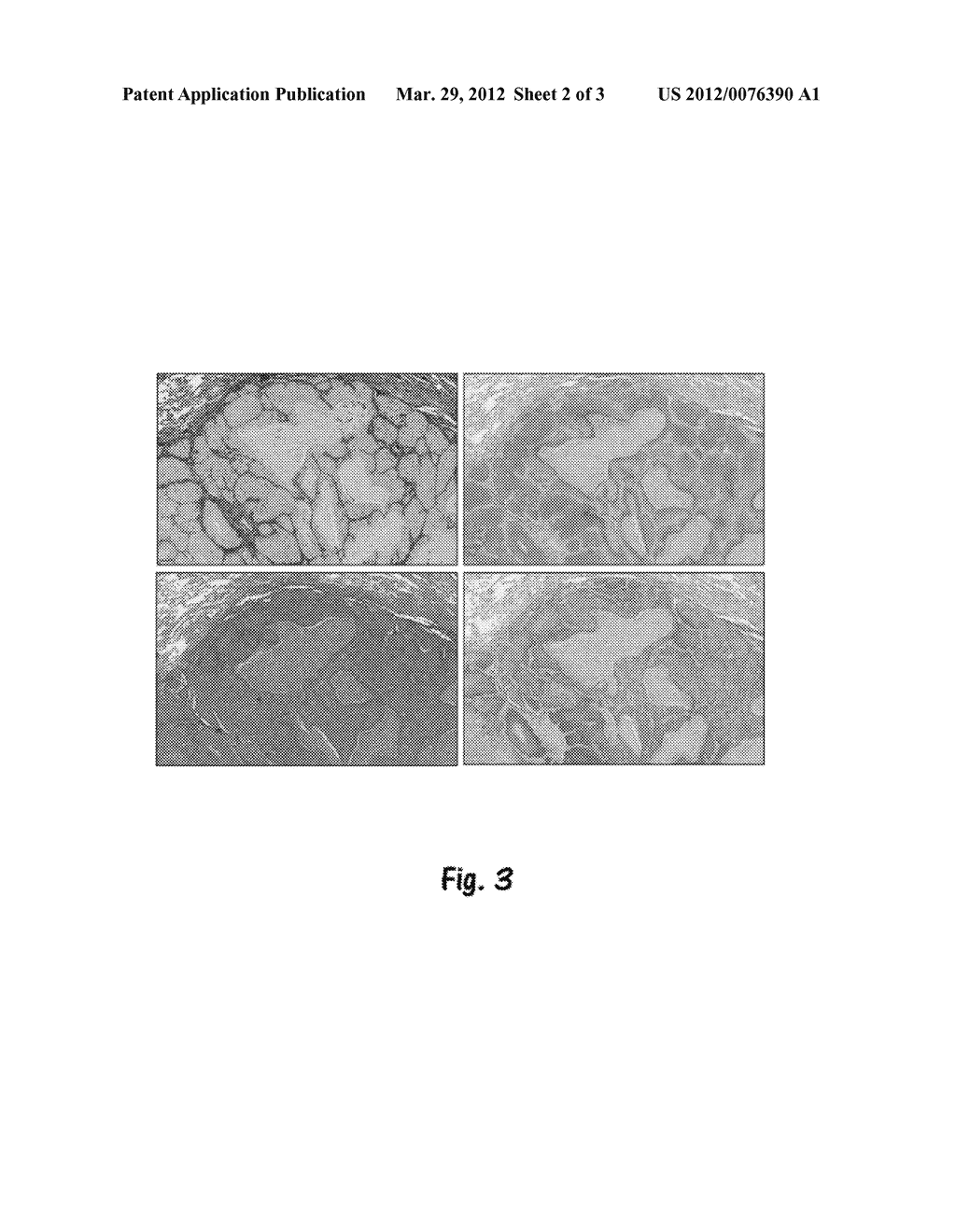 METHODS FOR FEATURE ANALYSIS ON CONSECUTIVE TISSUE SECTIONS - diagram, schematic, and image 03