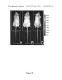 Lymphedema associated genes and model diagram and image