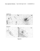 Lymphedema associated genes and model diagram and image