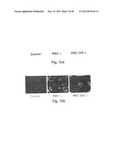 METHODS AND PHARMACEUTICAL COMPOSITIONS FOR HEALING WOUNDS diagram and image