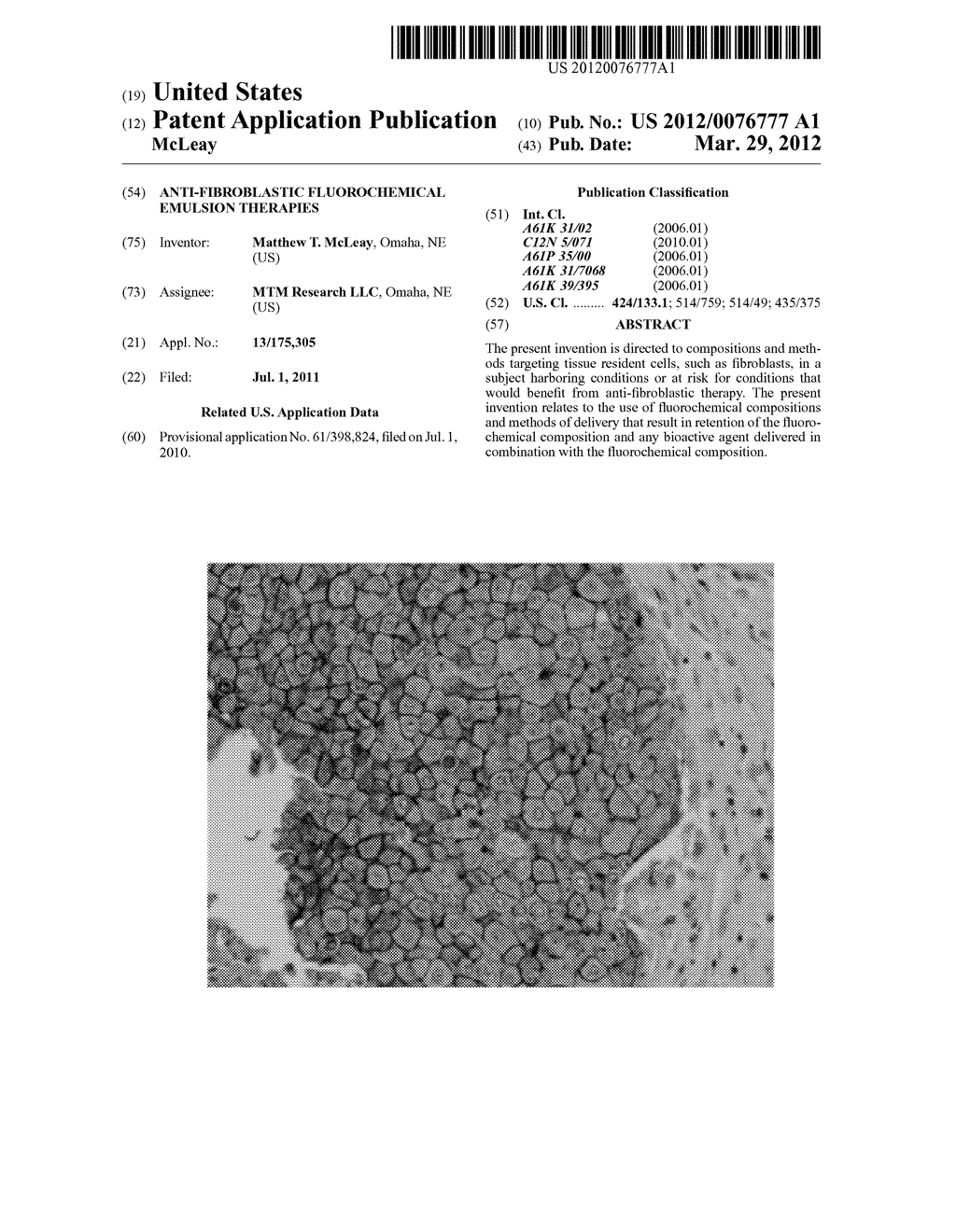 ANTI-FIBROBLASTIC FLUOROCHEMICAL EMULSION THERAPIES - diagram, schematic, and image 01