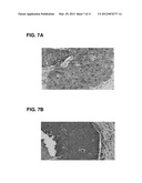 ANTI-FIBROBLASTIC FLUOROCHEMICAL EMULSION THERAPIES diagram and image