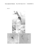 COMBINATION OF A TNF-ALPHA ANTAGONIST AND A VEGF ANTAGONIST FOR USE IN THE     TREATMENT OR PREVENTION OF DISEASES OF THE EYE diagram and image