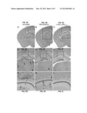 ANTIGENIC CHIMERIC TICK-BORNE ENCEPHALITIS VIRUS/DENGUE VIRUS TYPE 4     RECOMBINANT VIRUSES diagram and image