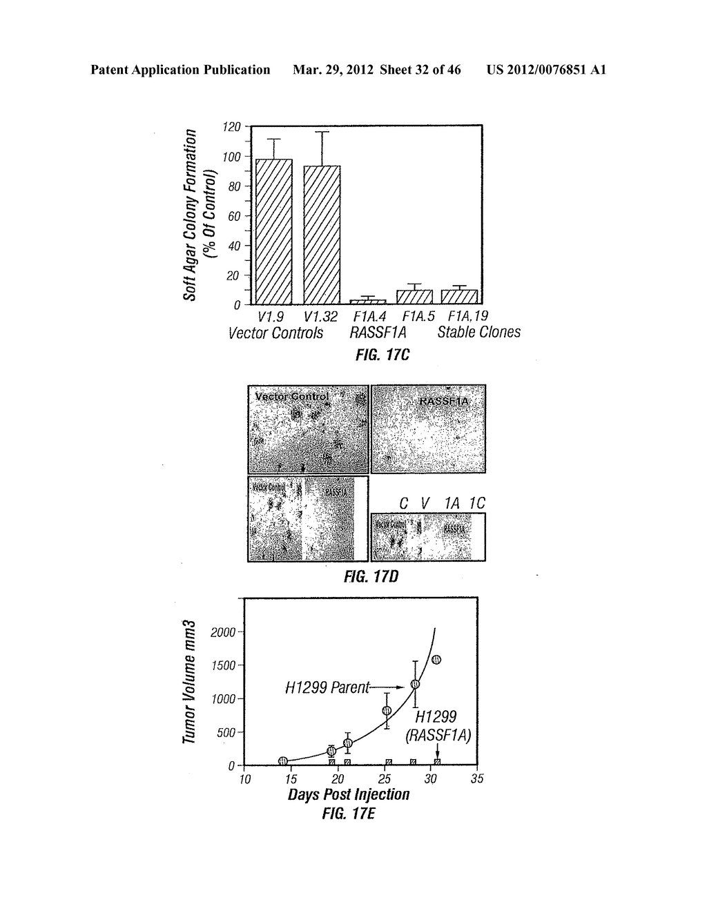 CHROMOSOME 3p21.3 GENES ARE TUMOR SUPPRESSORS - diagram, schematic, and image 33