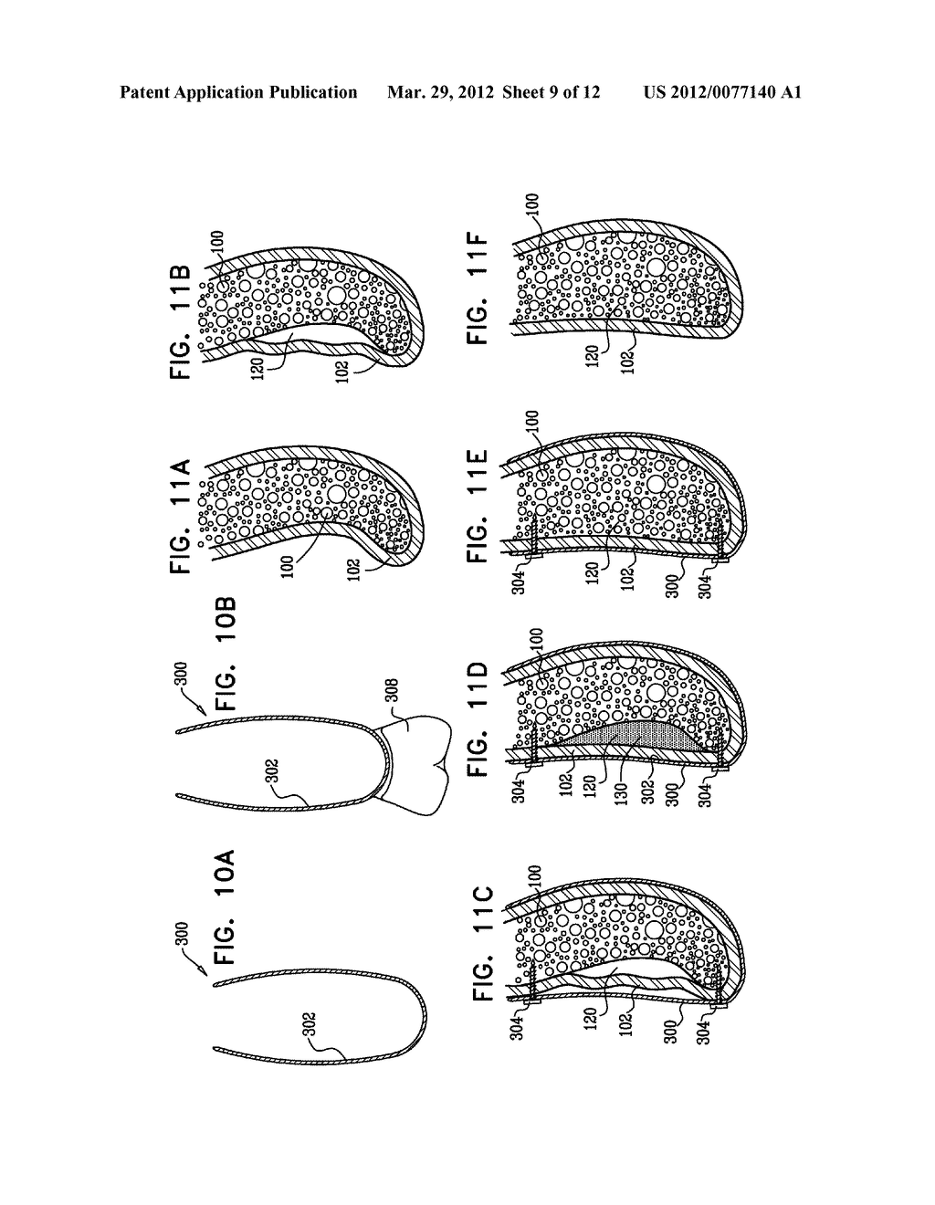 PERIOSTEAL MESHER - diagram, schematic, and image 10