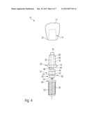 Dental Implant System diagram and image