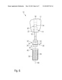 Dental Implant System diagram and image