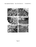 USE OF A PROTEIN IN STEM CELL AND CANCER APPLICATIONS diagram and image