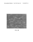 DIFFERENTIATION OF MULTI-LINEAGE PROGENITOR CELLS TO CHONDROCYTES diagram and image