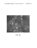 DIFFERENTIATION OF MULTI-LINEAGE PROGENITOR CELLS TO CHONDROCYTES diagram and image