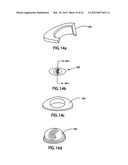 Muscle-Back, with Insert, Iron Type Golf Club Head diagram and image