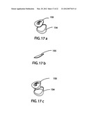 Muscle-Back, with Insert, Iron Type Golf Club Head diagram and image