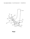 Muscle-Back, with Insert, Iron Type Golf Club Head diagram and image