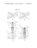 DESCENT APPARATUS diagram and image