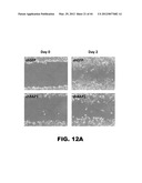 COMPOSITIONS AND METHODS FOR DETECTING CANCER METASTASIS diagram and image