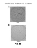 COMPOSITIONS AND METHODS FOR DETECTING CANCER METASTASIS diagram and image