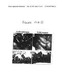 Use of Toll-like receptor-9 agonists, Toll-like receptor-4 antagonists,     and/or nuclear oligomerization domain-2 agonists for the treatment or     prevention of Toll-like receptor-4-associated disorders diagram and image