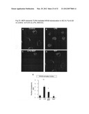 Use of Toll-like receptor-9 agonists, Toll-like receptor-4 antagonists,     and/or nuclear oligomerization domain-2 agonists for the treatment or     prevention of Toll-like receptor-4-associated disorders diagram and image