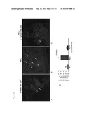 Use of Toll-like receptor-9 agonists, Toll-like receptor-4 antagonists,     and/or nuclear oligomerization domain-2 agonists for the treatment or     prevention of Toll-like receptor-4-associated disorders diagram and image