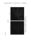 Use of Toll-like receptor-9 agonists, Toll-like receptor-4 antagonists,     and/or nuclear oligomerization domain-2 agonists for the treatment or     prevention of Toll-like receptor-4-associated disorders diagram and image