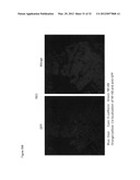 Use of Toll-like receptor-9 agonists, Toll-like receptor-4 antagonists,     and/or nuclear oligomerization domain-2 agonists for the treatment or     prevention of Toll-like receptor-4-associated disorders diagram and image